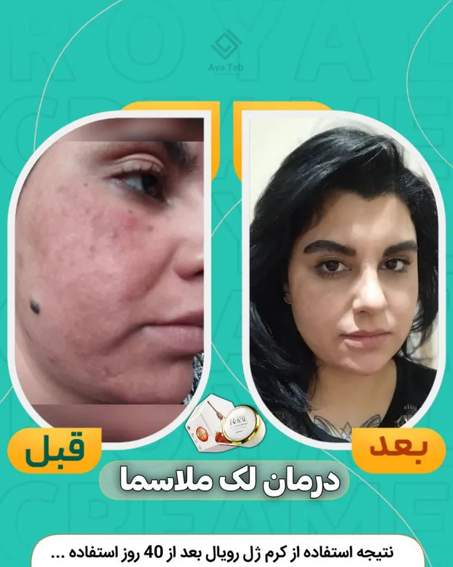 کرم ضد لک و جوان ساز رویال اصلی