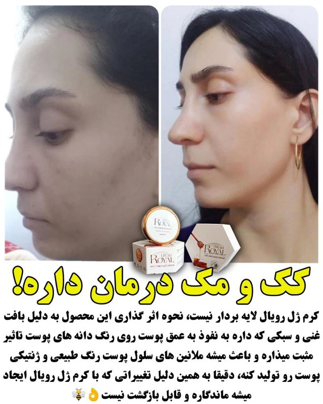 کرم ضد لک و جوان ساز رویال اصلی